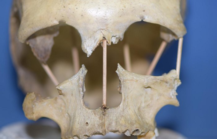 DNA From 35,000-Year-Old Romanian Skull Sheds New Light On The Theory Of Evolution