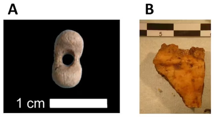 Ancient Skulls From Ukraine Reveal Early Modern Humans Came From The East