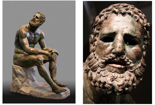 Boxer At Rest - Rare Sculpture And Masterpiece Of Hellenistic Bronze Age Art