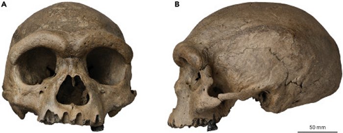 The Harbin cranium