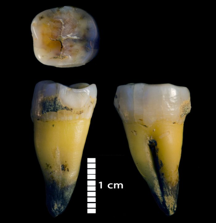 Second lower molar of a modern human found in Bacho Kiro Cave in the Main sector ᴀssociated with the Initial Upper… [more] © MPI-EVA/ Rosen Spasov