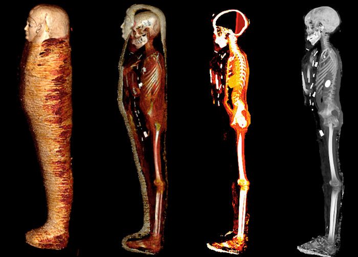 Egyptian 'Golden Boy' Mummy Was Protected By 49 Precious Amulets - CT Scans Reveal