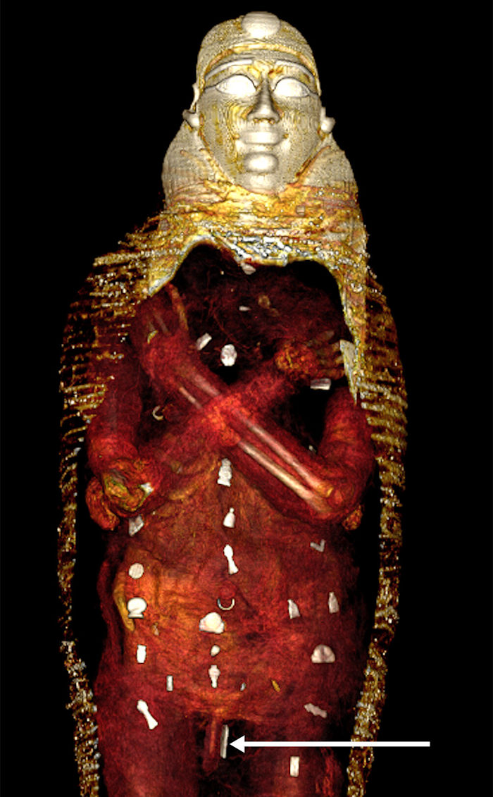 Egyptian 'Golden Boy' Mummy Was Protected By 49 Precious Amulets - CT Scans Reveal