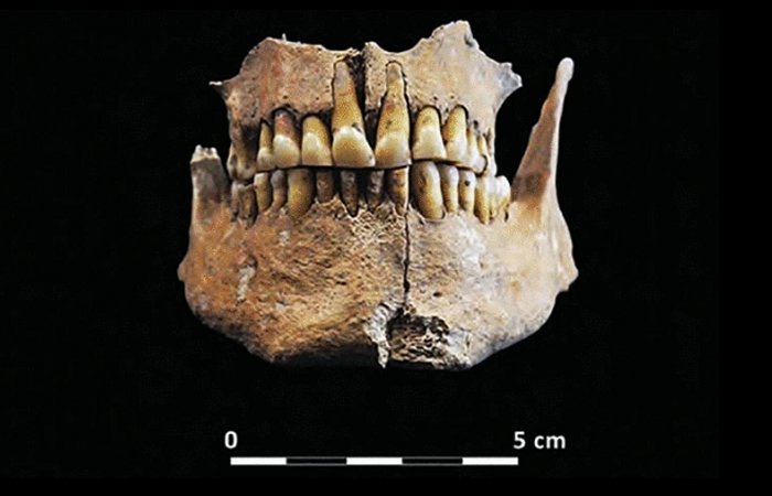 Unusual Neolithic Burial From Grotta Di Pietra Sant' Angelo Puzzles Archaeologists