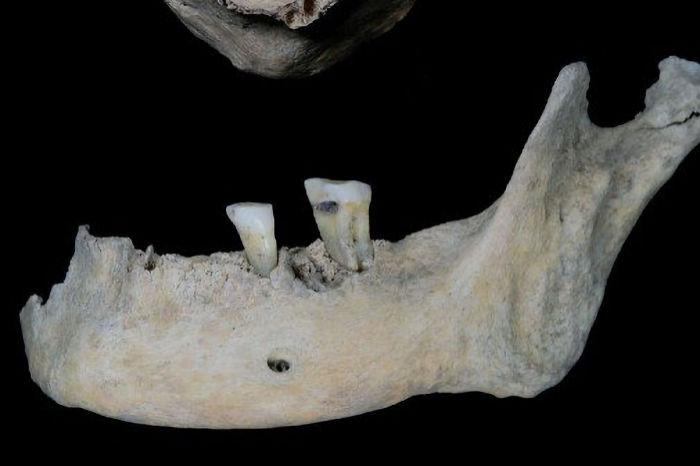 2,000-Year-Old Teeth Reveal The Diet Of An Iron Age Woman