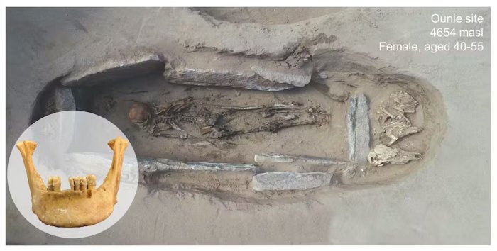 One of the individuals we studied was a woman, aged 40-55, buried at the Ounie site. Hers were the highest alтιтude (4654 masl) remains studied, dated to around 601-758 CE. Li Tang and Zujun Chen, Author provided