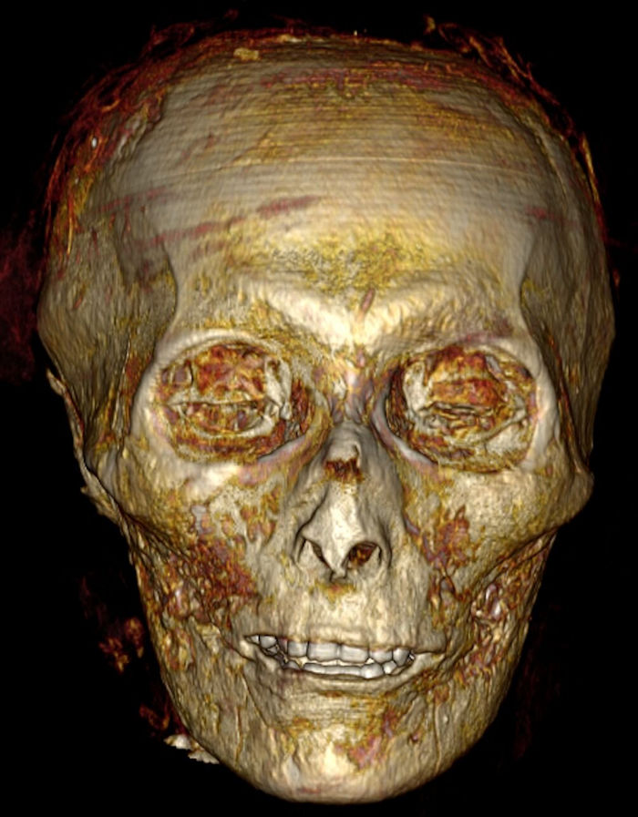 Mummy Of Pharaoh AmenH๏τep I Digitally Unwrapped For The First Time In 3,000 Years