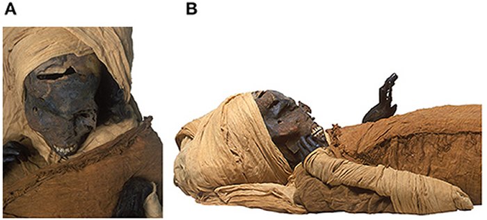 Pharaoh Seqenenre Taa II The Brave Was Brutally Killed By Hyksos Invaders Died And His Wounds Were Deliberately Concealed - Mummy Scans Reveals