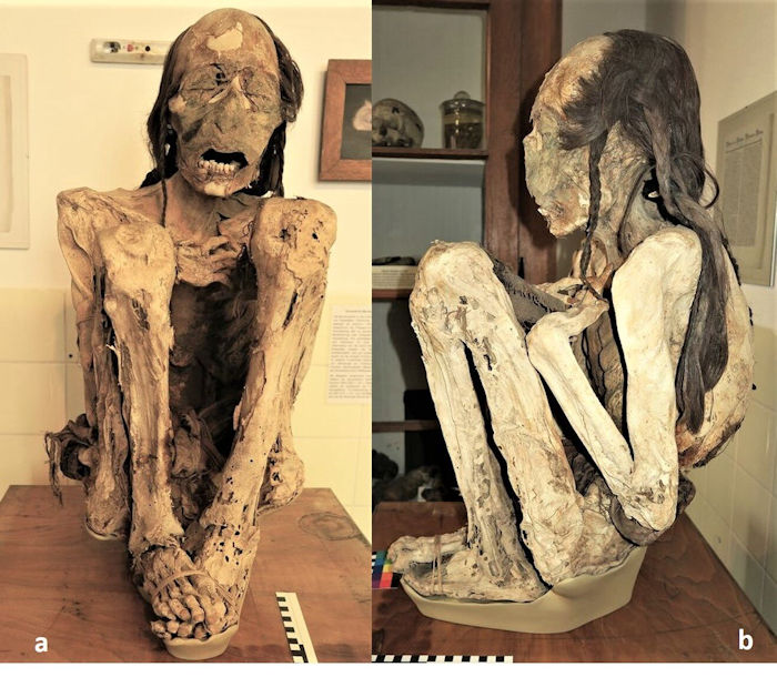 Scientific 'Detective Work' With South American Mummies Reveals They Were Brutally Murdered